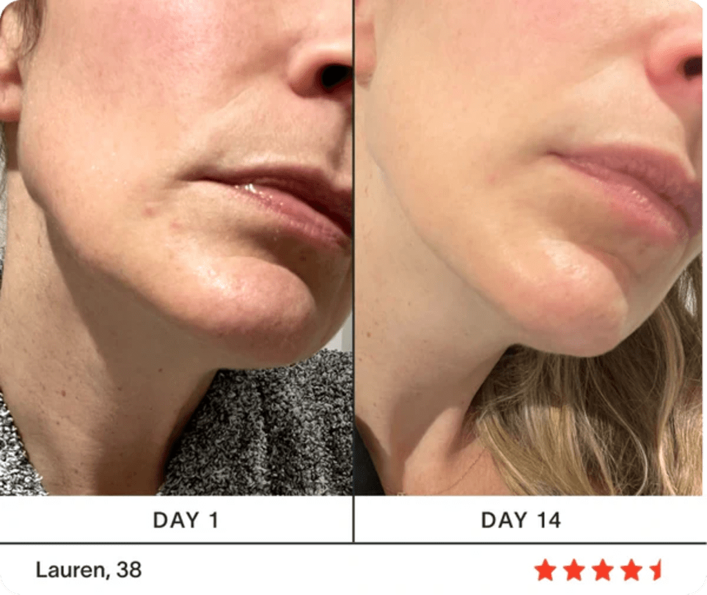 Ultimate 4-in-1 Skincare Wand Kit