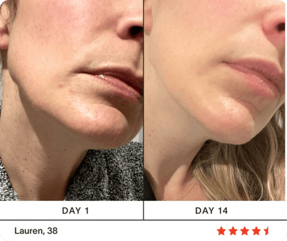 Ultimate 4-in-1 Skincare Wand Kit