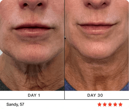 Ultimate 4-in-1 Skincare Wand Kit